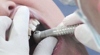 Депульпирование зуба