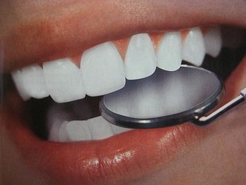 Зубные импланты Prodigy