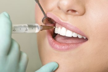 Анестезия и наркоз в стоматологии