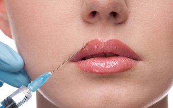Увеличение губ - пластика губ