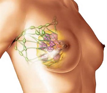 Заболевания груди у женщин